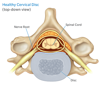 top down healthy cervical disc