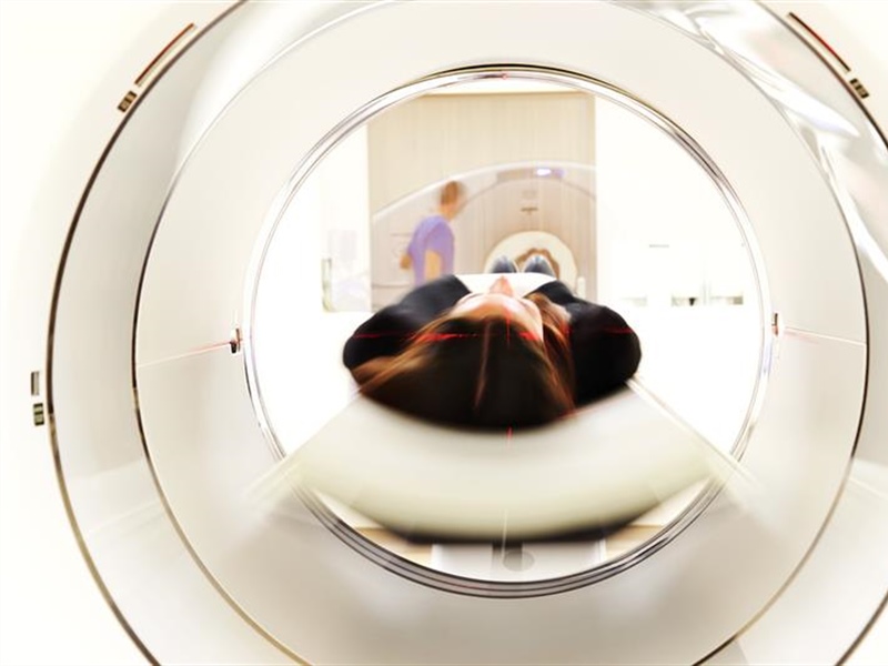 What to Expect from a Cervical MRI Scan