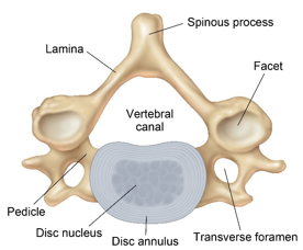 Cervical Disc Herniation Treatment | Disc Bulge